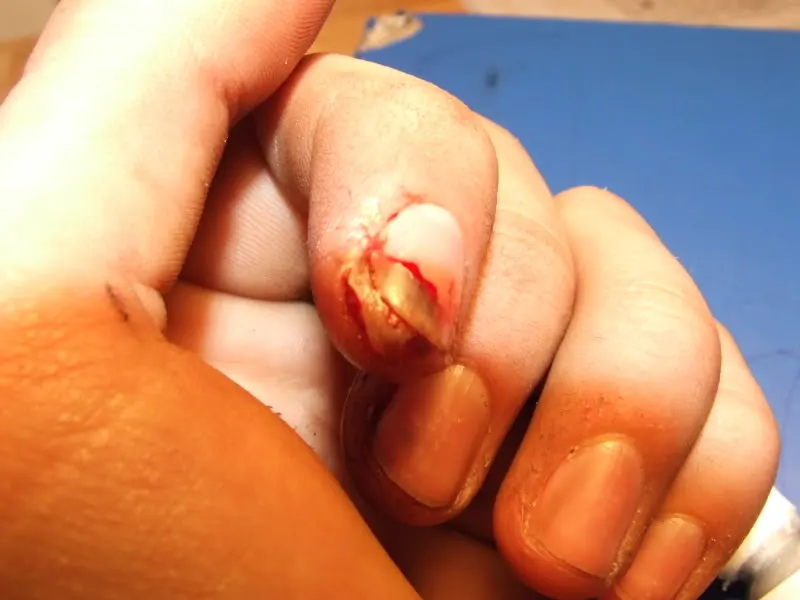 finger5.webp