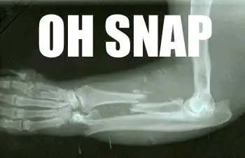 ohsnap.webp