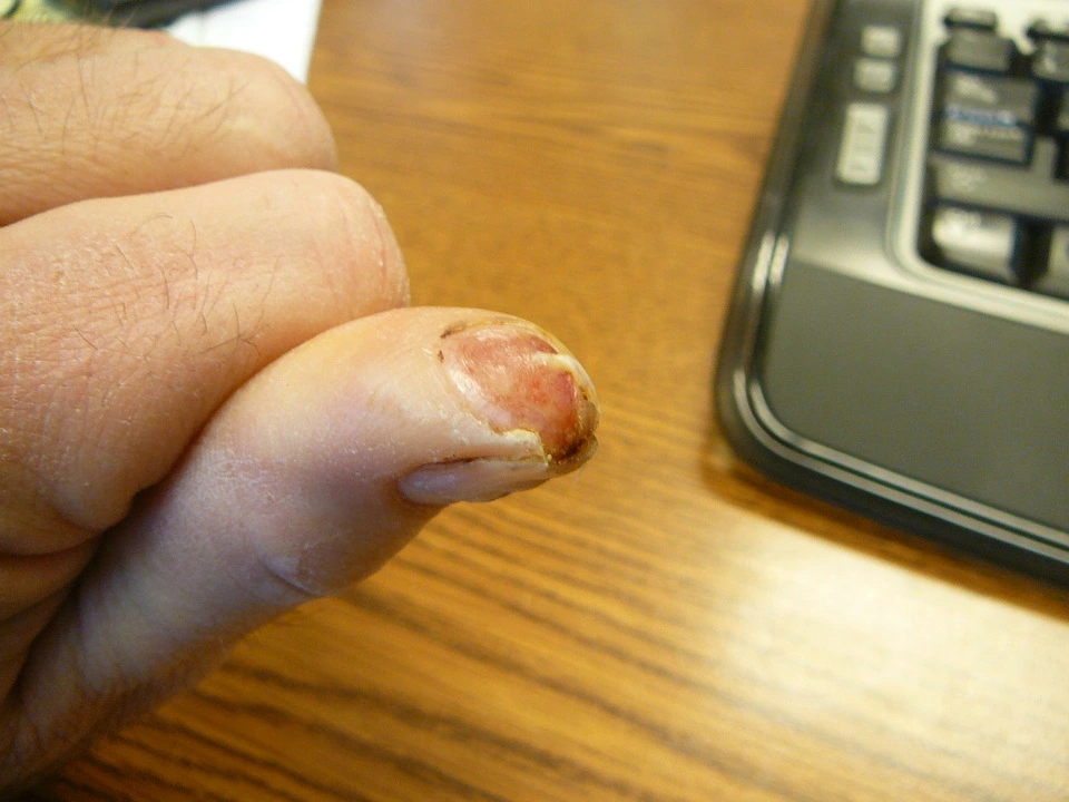 thumb.webp