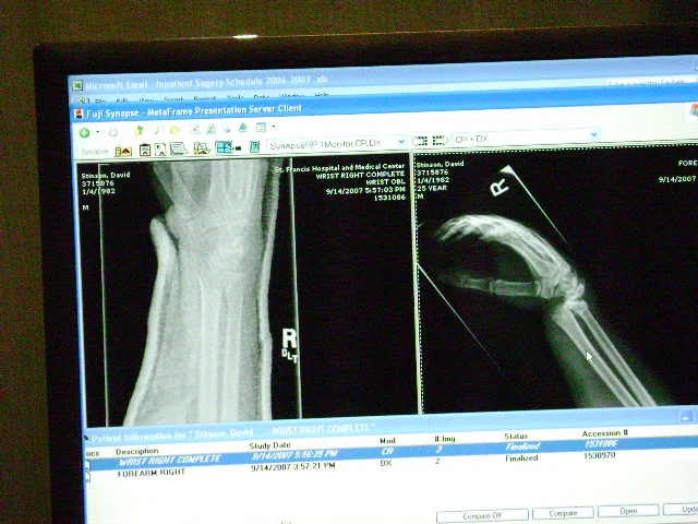 xray2.webp